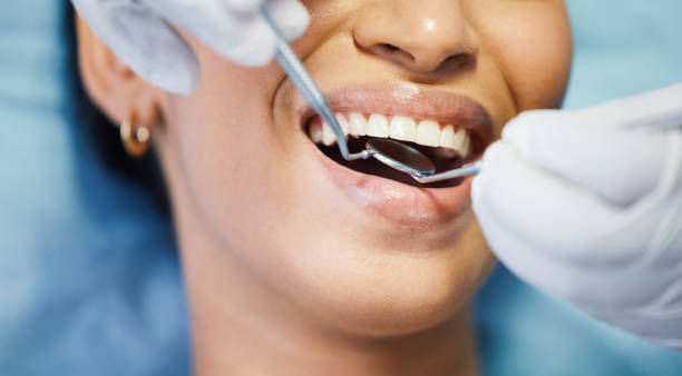 Best Emergency Broken Tooth Repair in Holmen, WI